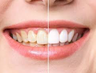 61cdb5fd0ba45a15adc7a393cbc128a0f8e49749